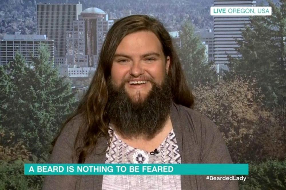 BRADATA DEVICA: Posle 25 godina odlučila je da prestane da se brije! I svi su oduševljeni zbog toga! (FOTO) (VIDEO)