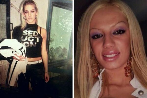 ODUVEK JE ODBIJALA DA PRIČA O TOME, ALI SAD JE NAPOKON PROGOVORILA! Evo koje sve plastične operacije je radila Soraja! (FOTO)