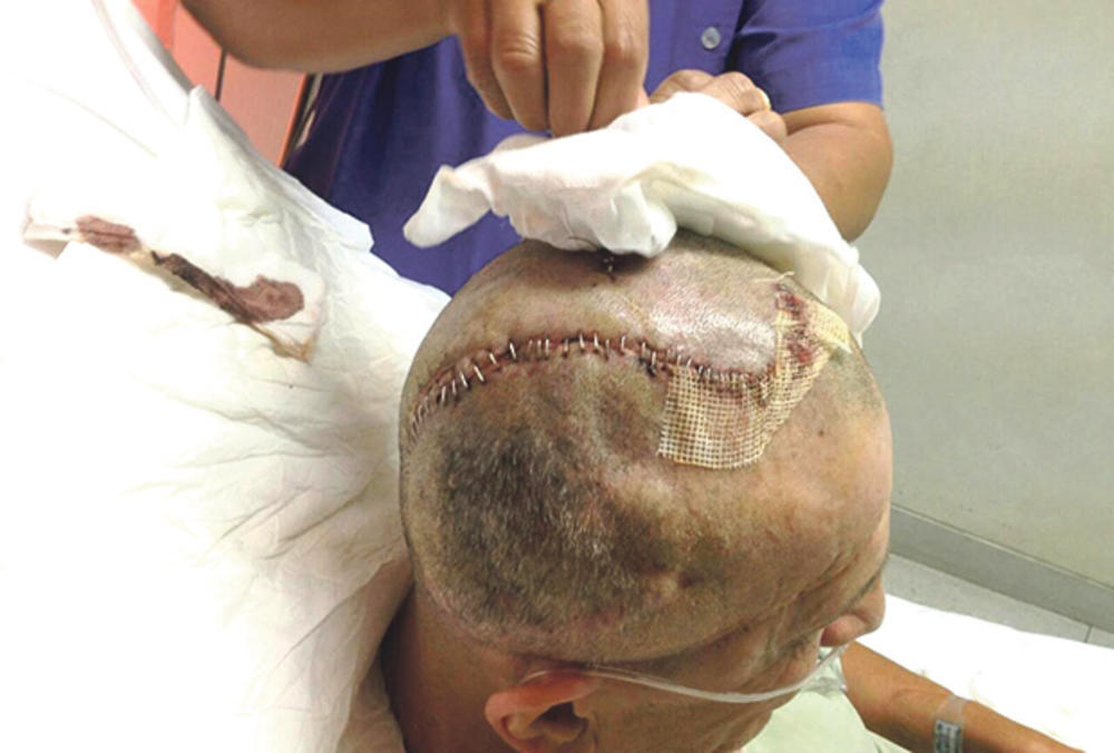 Nebojša Tubić imao je teške operacije 