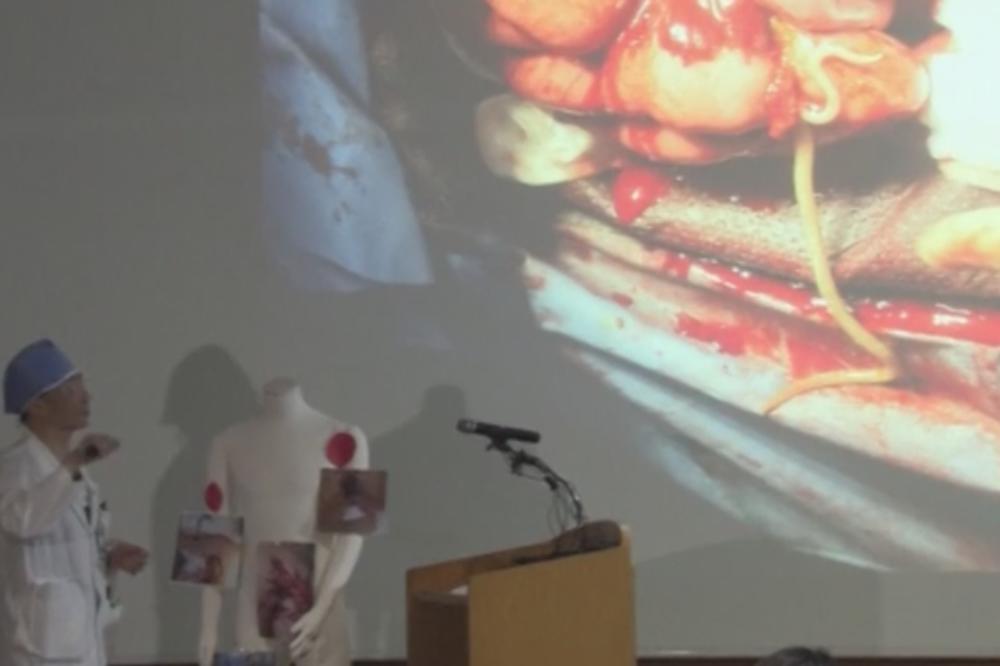 ISTINSKI HOROR: Vojniku koji je pobegao iz Severne Koreje U STOMAKU pronašli nešto što LEDI KRV U ŽILAMA! (VIDEO)