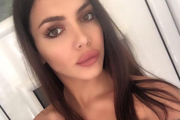 HELENA TOPALOVIĆ NEKADA I SADA: Pre NAPUMPAVANJA USTA Topalkova ćerka bila je POTPUNO DRUGA DEVOJKA