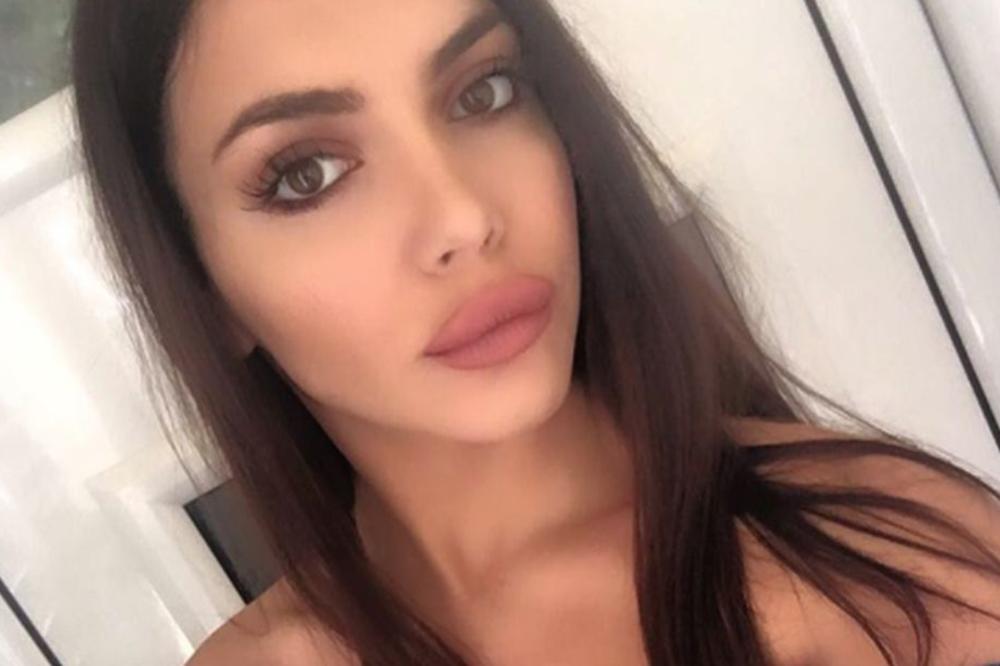 HELENA TOPALOVIĆ NEKADA I SADA: Pre NAPUMPAVANJA USTA Topalkova ćerka bila je POTPUNO DRUGA DEVOJKA