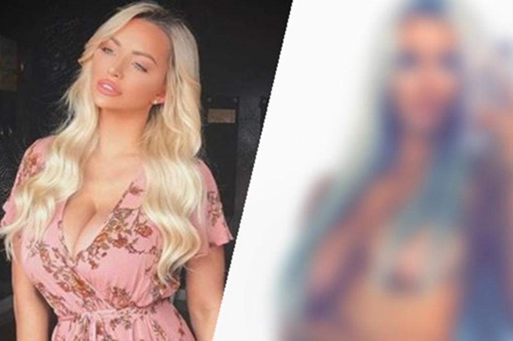 ŠTA TI JE TO SA GRUDIMA??? Plejbojeva zečica fotkom u toplesu izazvala žestoku raspravu na internetu (FOTO)