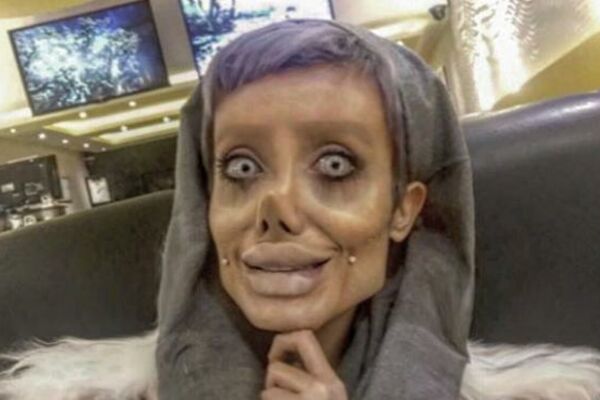 OPERISALA SE 50 PUTA DA LIČI NA ANĐELINU DŽOLI: Sada je kao mrtvac i UPLAŠIĆETE se od nje! (FOTO)