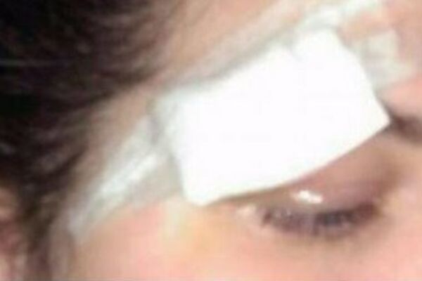 SVA U MODRICAMA I PODLIVIMA Dečko brutalno pretukao učesnicu FARME, a ona objavila sve na FEJSBUKU! (FOTO)