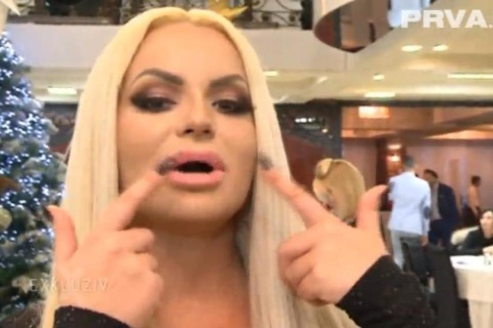 OD NAJVEĆIH DO NAJMANJIH USTA ESTRADE: Džidža se odlučila na šokantnu promenu, pogledajte kako sada izgleda