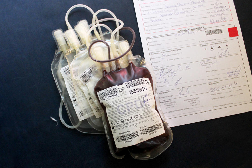 OVAJ PARAMETAR U KRVI OTKRIVA DA IMATE PROBLEM SA JETROM I ŽUČI: Stradaju vam ORGANI, ove VREDNOSTI su upozorenje