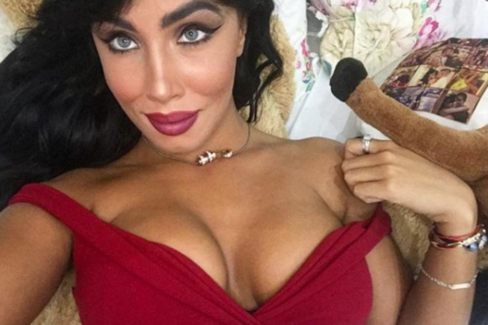 OD RUŽNOG PAČETA DO IZGLEDA JEFTINE PO**O GLUMICE: Aleksandri Subotić se smeje internet zbog fotki pre operacija