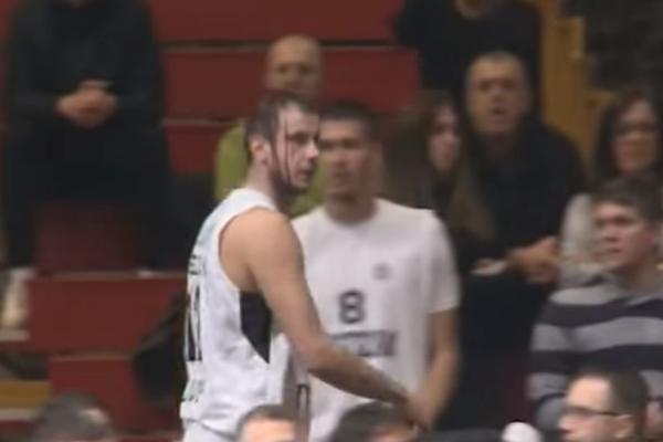 PALA JE KRV I U PIONIRU! Kapiten Partizana je završio razbijene i okrvavljene glave tokom meča sa Bilbaom! (VIDEO)