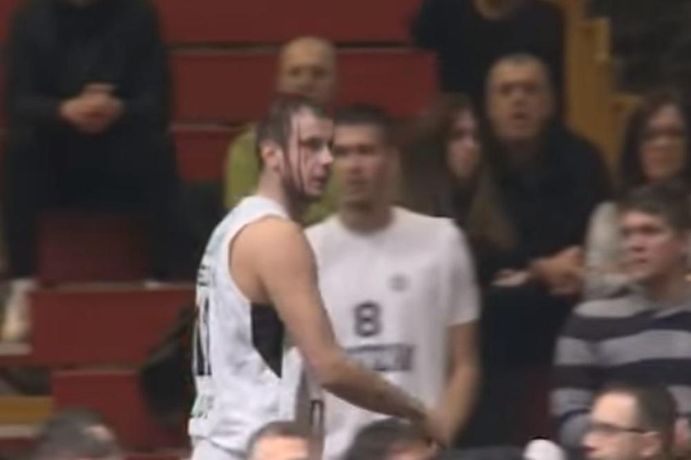 PALA JE KRV I U PIONIRU! Kapiten Partizana je završio razbijene i okrvavljene glave tokom meča sa Bilbaom! (VIDEO)