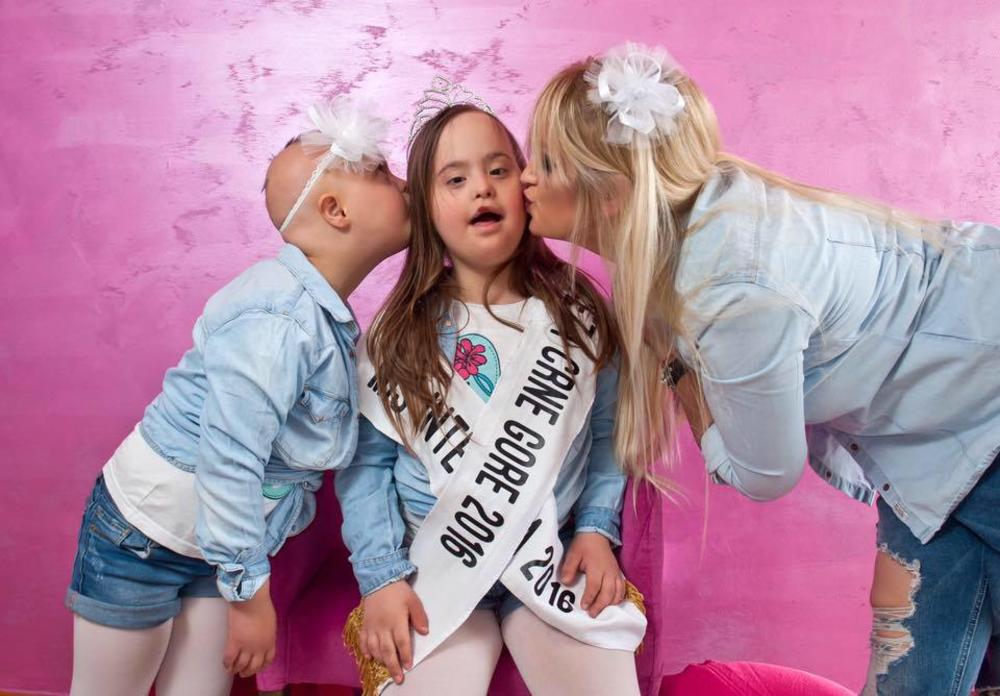 SVETSKI DAN OSOBA SA DAUNOVIM SINDROMOM