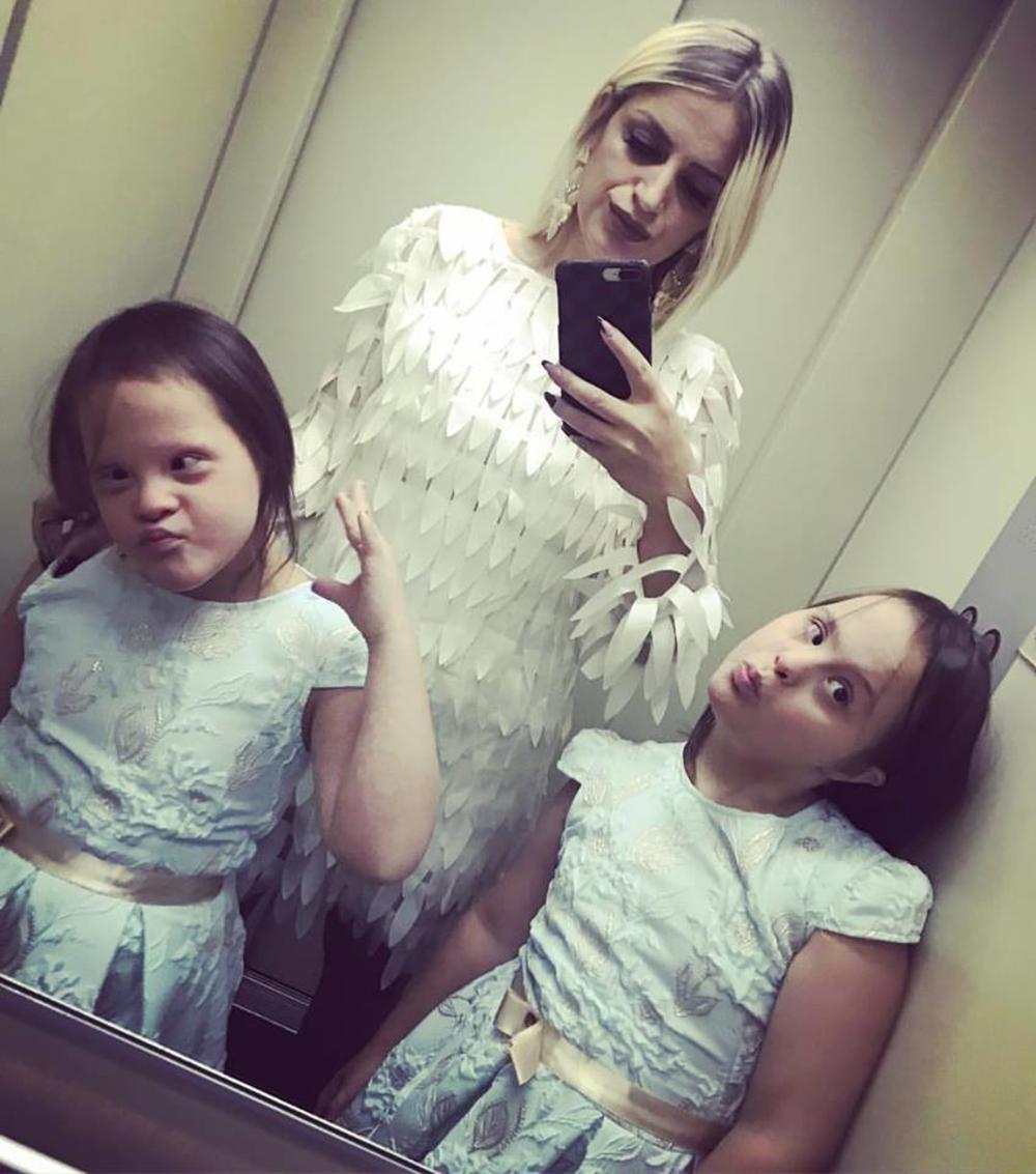 SVETSKI DAN OSOBA SA DAUNOVIM SINDROMOM