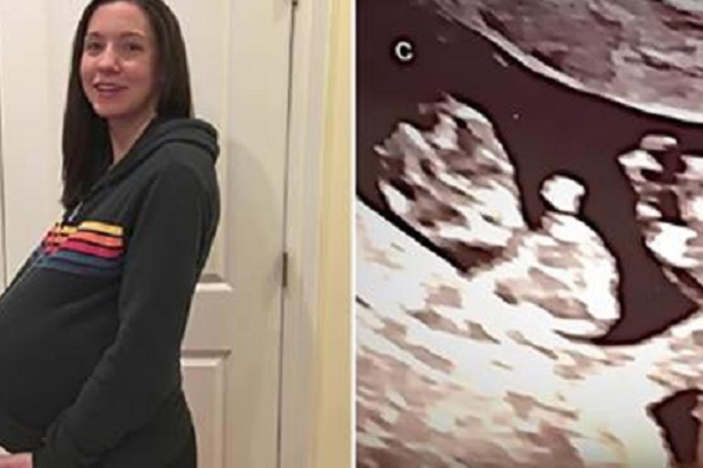 FENOMEN KOJI JE DOKTORE OSTAVIO BEZ REČI: Majka je trudna s trojkama, onda je doktor bolje pogledao ultrazvuk i prebledeo!