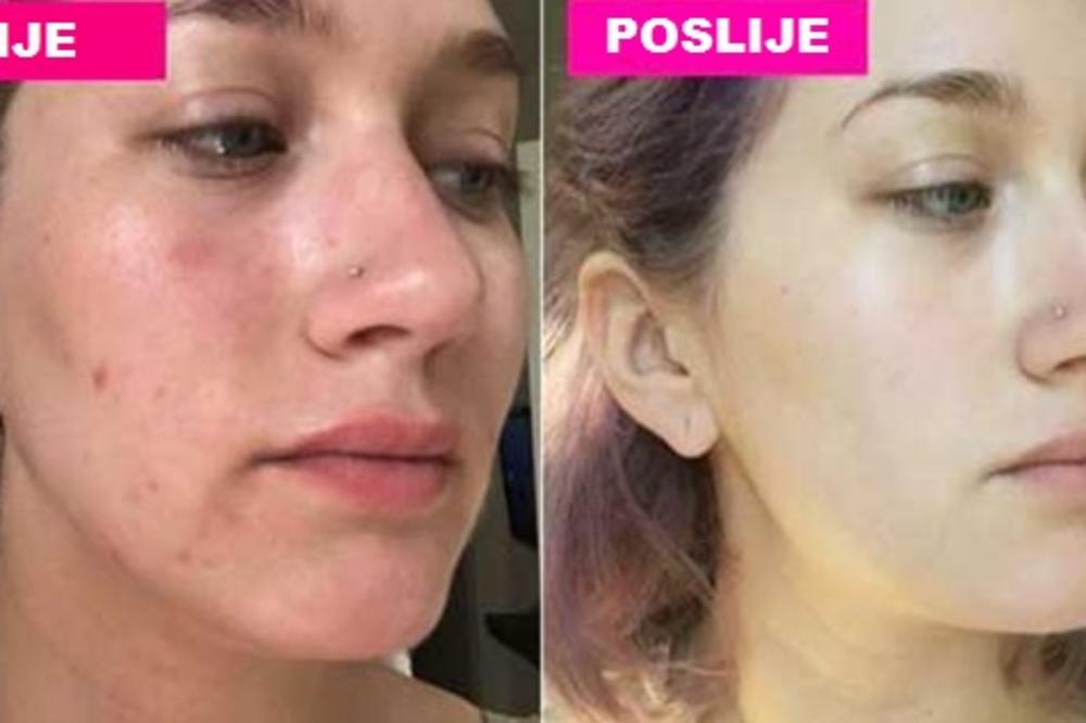 Ujutru obavezno napravite ovu tečnost i operite lice: Izgled kože će vam se odmah popraviti!