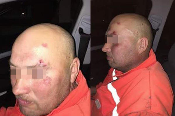 ONI SU NAŠA BRAĆA, NEČIJA DECA I RODITELJI: Radnici Gradske čistoće su brutalno pretučeni, a ovo je DIRLJIVI APEL NJIHOVIH KOLEGA! (FOTO)