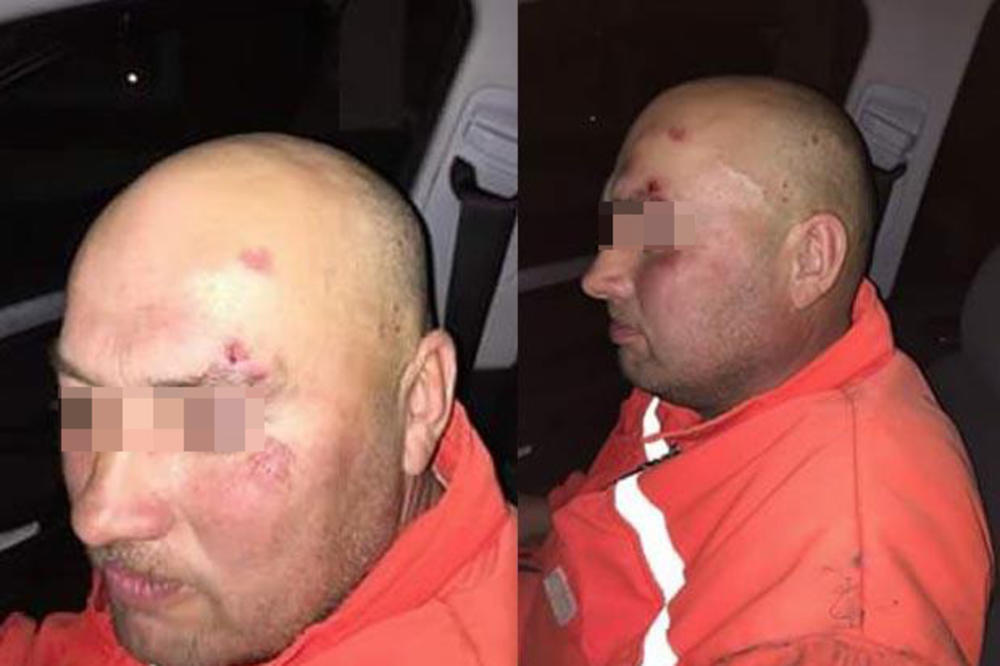 ONI SU NAŠA BRAĆA, NEČIJA DECA I RODITELJI: Radnici Gradske čistoće su brutalno pretučeni, a ovo je DIRLJIVI APEL NJIHOVIH KOLEGA! (FOTO)