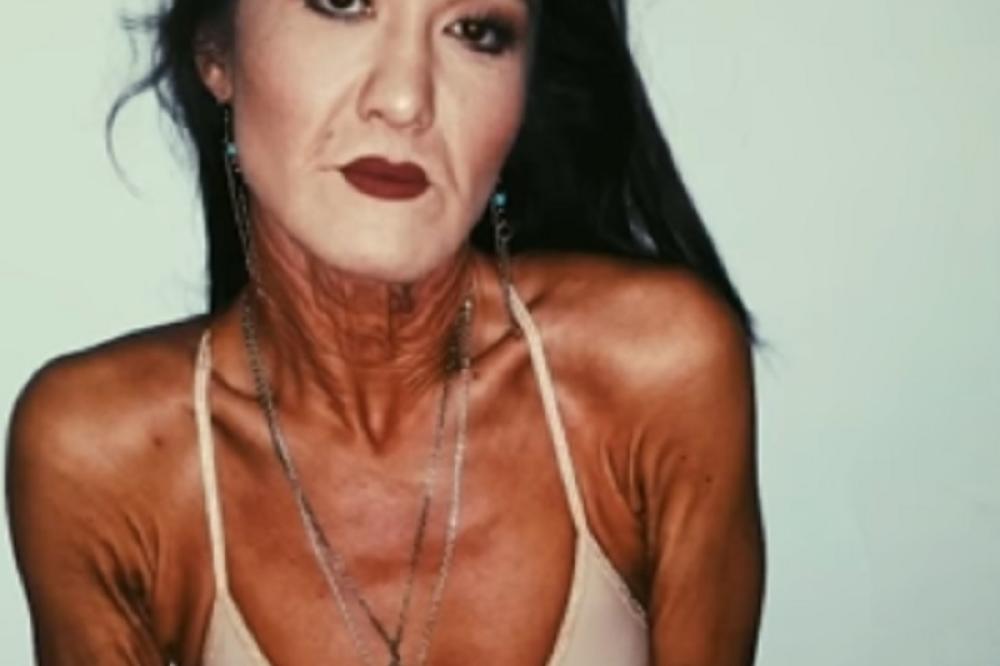 SARA IMA 26 GODINA, A NE SME DA POKAŽE SVOJE TELO! Kada se skine, ljudi BEŽE, A OVO SE DEŠAVA 1 OSOBI U MILION!