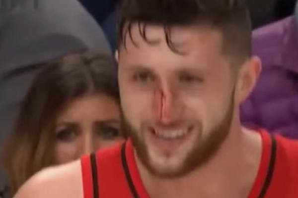 NURKIĆ JE ZVERINA! Popio udarac u nos, krv je liptala na sve strane, ali on se sve vreme SMEJAO KAO LUD! (VIDEO)