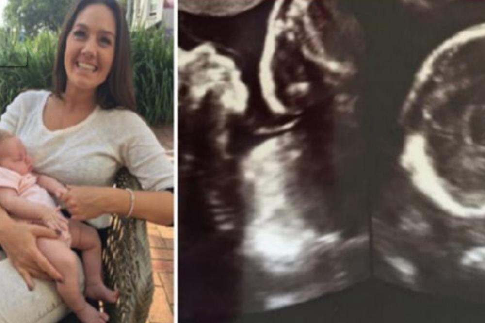 MAMA JE RODILA ZDRAVU BEBU: Šest sedmica kasnije, osetila je da nešto nije uredu i doktori su uradili ultrazvuk...