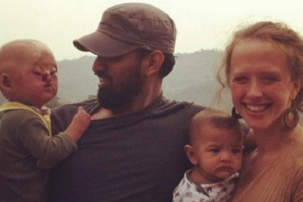 ROĐEN JE BEZ NOSA PA GA JE MAJKA OSTAVILA DA UMRE: A danas izgleda ovako!