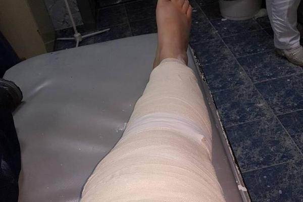 PRVA FOTOGRAFIJA UNAKAŽENE KOMUNALNE POLICAJKE: Taksista je prvo izvređao i psovao, pa ONDA PREGAZIO! (FOTO)