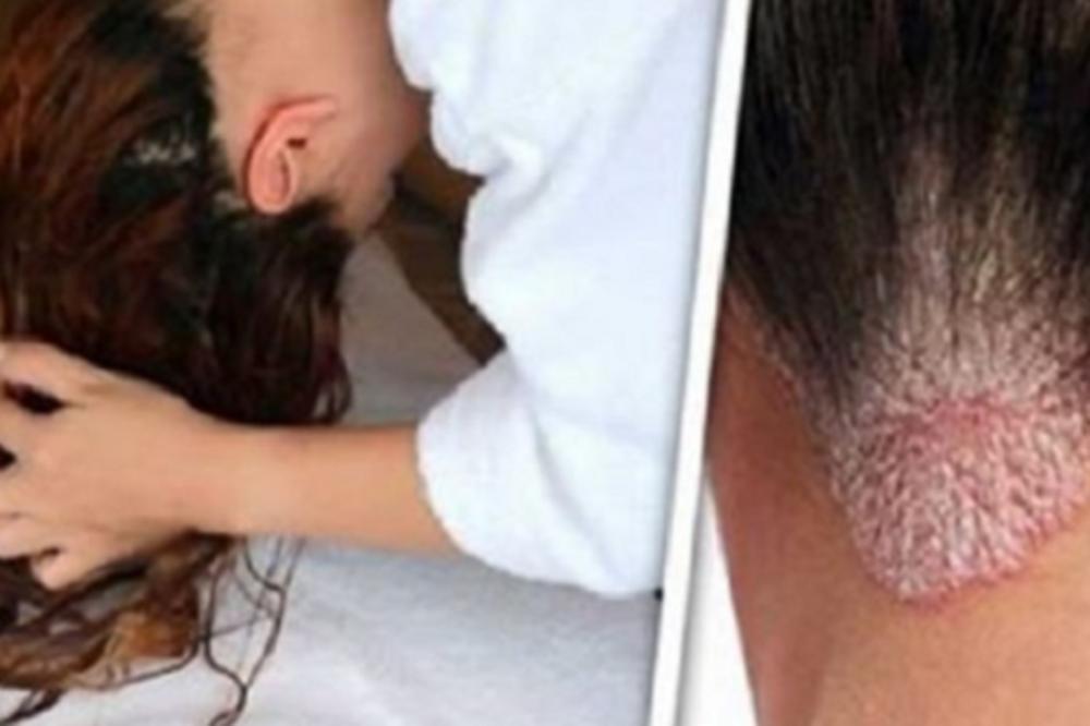 7 BOLESTI KOJE SU UZROKOVANE SPAVANJEM SA MOKROM KOSOM: Prestanite to da radite odmah!