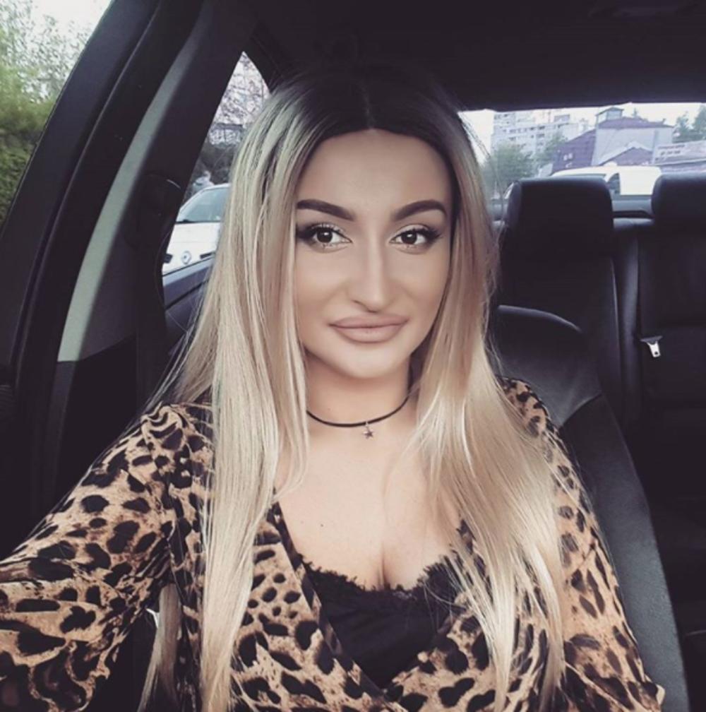 Andreana Čekić pre operacije nosa