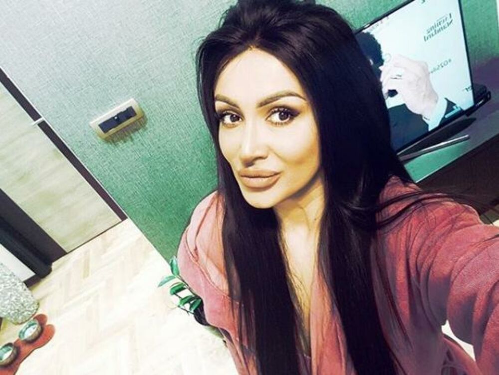 Plastičar je odradio dobar posao 