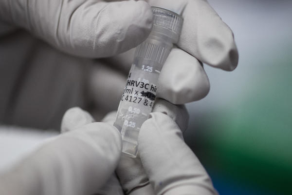 SPREMNI SMO ZA NOVU SEZONU: Vakcine protiv gripa su tu, SAD SU BOLJE, ali i SKUPLJE