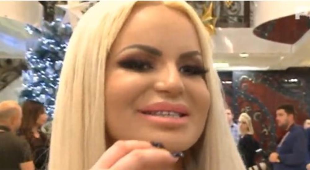 njena usta sada izgledaju prirodnije