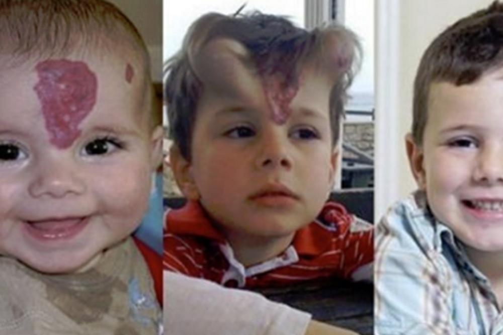 ROĐEN JE SA NEOBIČNIM MLADEŽOM NA GLAVI: Razlog zbog kog su mu doktori implantirali ROGOVE ĐAVOLA će vas ostaviti u čudu!