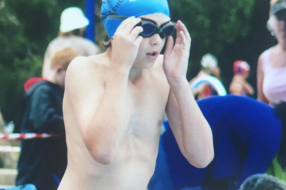 KAO DEČAKU SU MU SE RUGALI ZBOG UROĐENE MANE: Danas je odrastao i izgleda potpuno DRUGAČIJE! (FOTO)