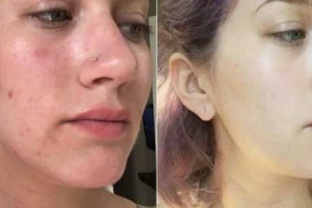 Svako jutro STAVLJALA JE OVO NA LICE! Kada se pogledala, nije mogla da se PREPOZNA!