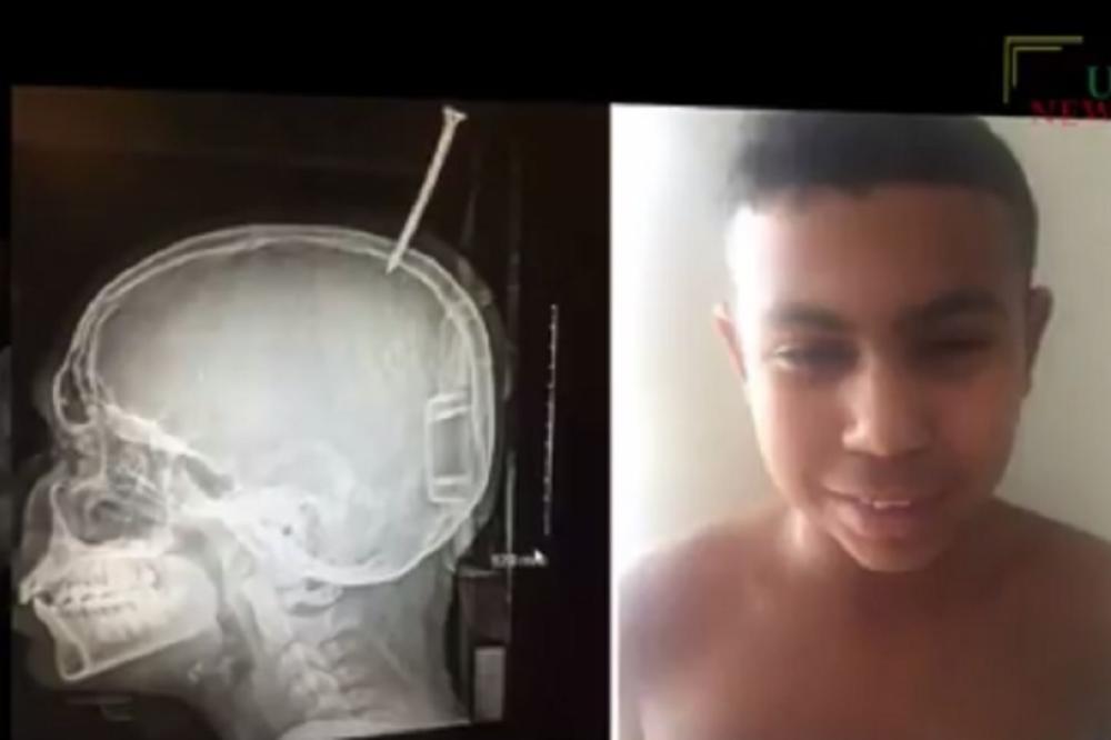 LEKAR SE ZGRANUO KADA JE VIDEO OVOG DEČAKA! DO sada nikada nije imao ovakav slučaj! (VIDEO)