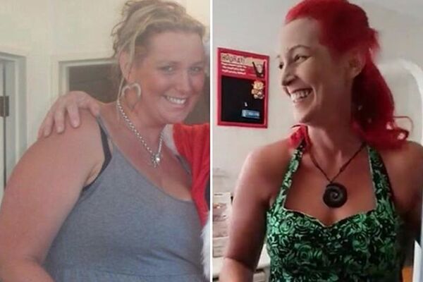 Odrekla se 4 namirnice i uspela da izgubi 70 kg: Sad svi u nju gledaju zabezeknuto!