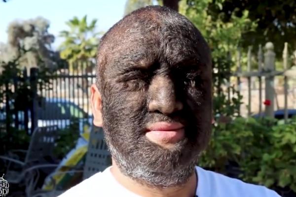 DLAKE MU PREKRIVAJU 98 ODSTO LICA! Lari je prihvatio činjenicu da je drugačiji i USPEO ONO ŠTO SU MISLILI DA NIKAD NEĆE! (VIDEO)