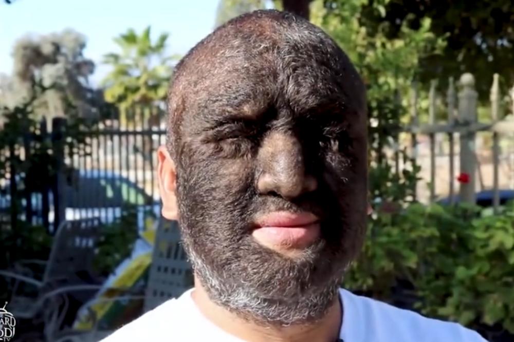 DLAKE MU PREKRIVAJU 98 ODSTO LICA! Lari je prihvatio činjenicu da je drugačiji i USPEO ONO ŠTO SU MISLILI DA NIKAD NEĆE! (VIDEO)