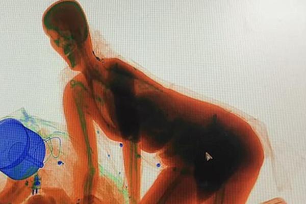 ŠOK NA RENDGENU: Obezbeđenje se zaprepastilo kada je ovo ugledalo! (FOTO)