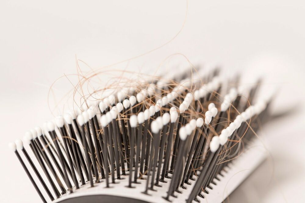 Proređivanje kose, kao i obrva može biti znak bolesti štitne žlezde  