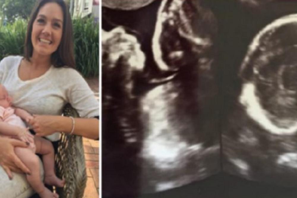 MAMA JE RODILA ZDRAVU BEBU: 6 sedmica kasnije, osetila je da nešto nije u redu i doktori su uradili ultrazvuk, a tamo, ŠOK!