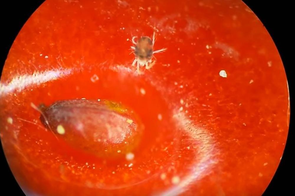 VIŠE NIKADA NEĆETE JESTI JAGODE KAD POGLEDATE OVAJ SNIMAK NAČINJEN MIKROSKOPOM: Evo KO je uhvaćen na njoj (VIDEO)