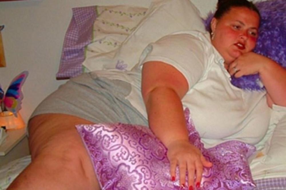 OVA BUCKA JE SMRŠALA 75 KILOGRAMA! Nije mogla da ustane iz kade, lomila je stolice, A ONDA JE ODLUČILA DA SVOJ ŽIVOT PROMENI IZ KORENA! (FOTO)