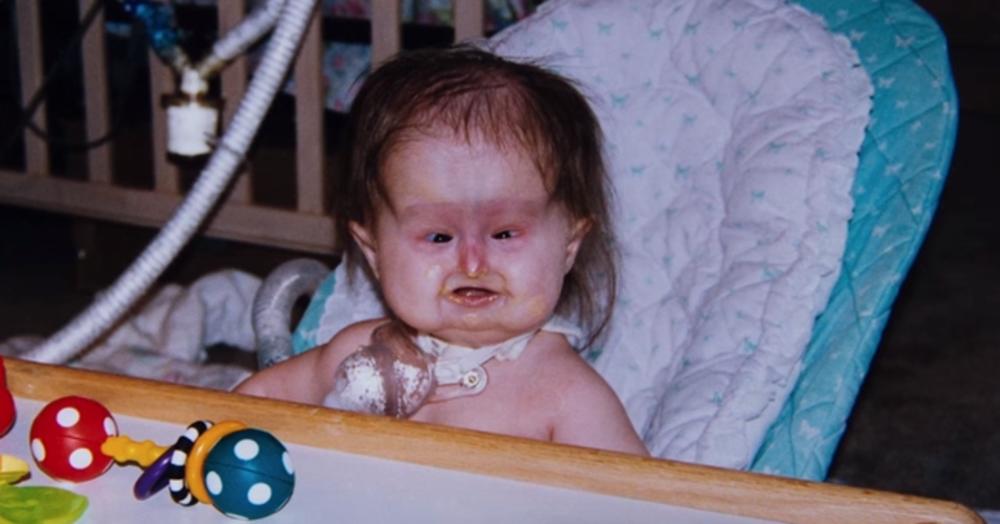 Već posle porođaja primećeno je oboljenje 