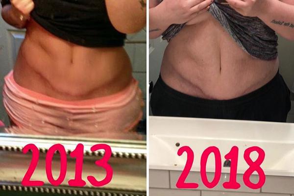 BILA JE MORBIDNO GOJAZNA, pa smršala do SAVRŠENSTVA: Vređali su je i pretili smrću ZBOG SAMO JEDNE STVARI sve dok se opet nije ugojila! (FOTO)