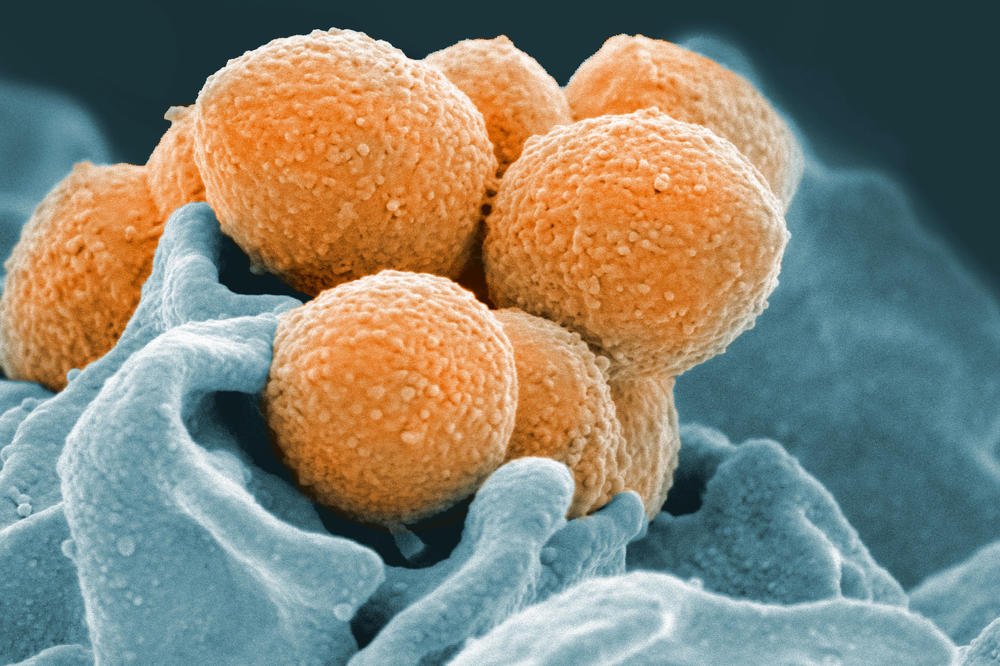 OVA BOLNIČKA BAKTERIJA JE TOLIKO JAKA DA MOŽE DA UBIJE ČOVEKA! Prenosi se kontaktom kože na kožu, a ovo su simptomi!