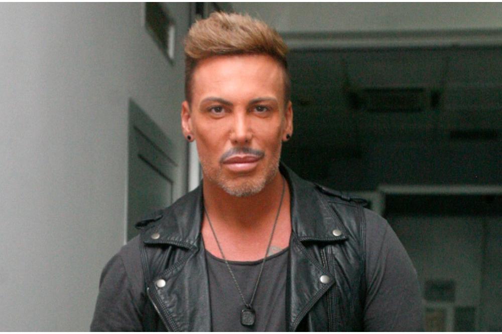 Usred PLASTIČNE OPERACIJE mu je stradao POLNI ORGAN, ali to ga nije zaustavilo, nego je otišao na sledeću (FOTO)