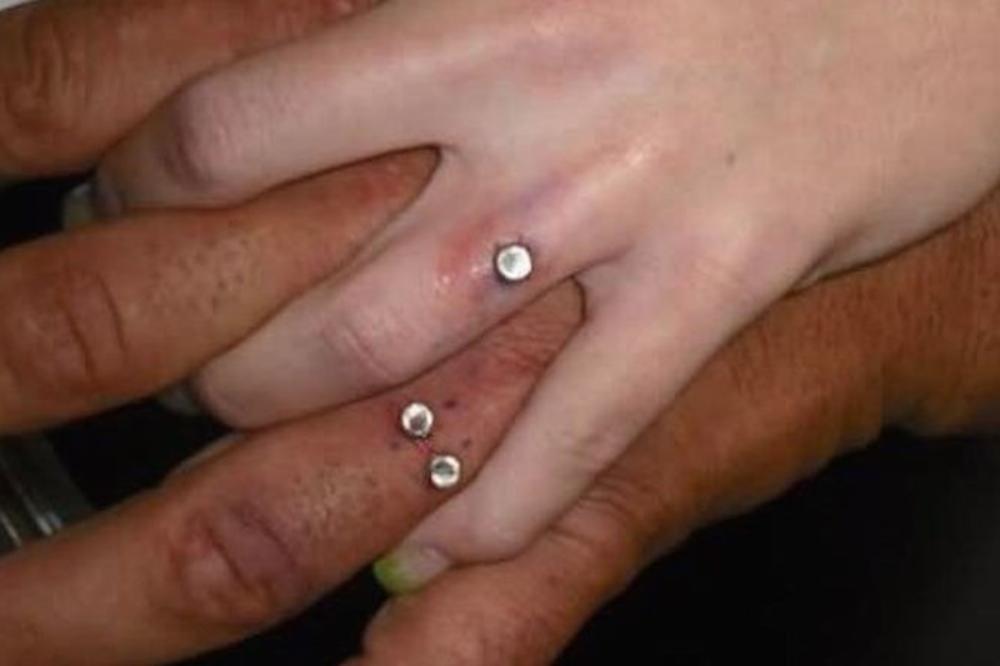 NOVI BOLESNI TREND: Da li je REALNO da sad ovo nose umesto VERENIČKOG PRSTENJA? (FOTO)