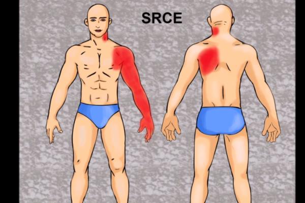 BOLI VAS RUKA? HITNO PROVERITE SRCE: Evo na koje ozbiljne bolesti ukazuju ovi bolovi u telu (VIDEO)