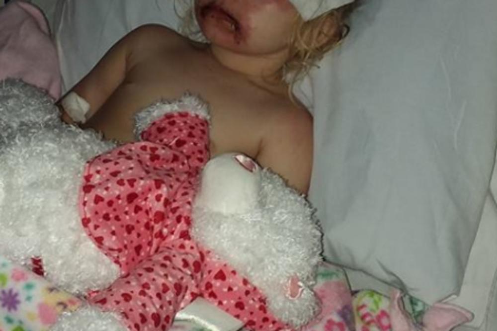 KUPILI SU ĆERKI BEZAZLENU IGRAČKU: Sledećeg dana je završila u bolnici, sa natečenim očima i ustima! (FOTO)