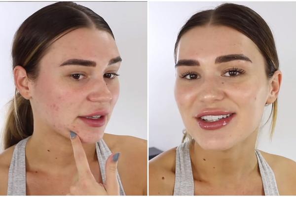 PREKRILA JE BUBULJICE ZA 5 MINUTA BEZ KORIŠĆENJA PUDERA: Pratite njene korake i efekat će vas ODUŠEVITI! (VIDEO)